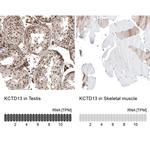 KCTD13 Antibody in Immunohistochemistry (IHC)