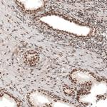 KCTD13 Antibody in Immunohistochemistry (IHC)