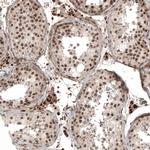 KCTD13 Antibody in Immunohistochemistry (IHC)