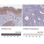 Spectrin beta-3 Antibody in Immunohistochemistry (IHC)