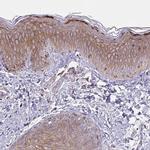 Spectrin beta-3 Antibody in Immunohistochemistry (IHC)