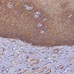 RPL5 Antibody in Immunohistochemistry (IHC)