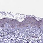 ARHGEF37 Antibody in Immunohistochemistry (IHC)