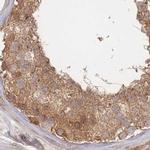 PSMD9 Antibody in Immunohistochemistry (IHC)