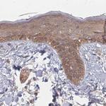 PSMD9 Antibody in Immunohistochemistry (IHC)