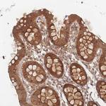 PSMD9 Antibody in Immunohistochemistry (IHC)