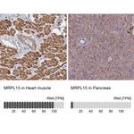 MRPL15 Antibody in Immunohistochemistry (IHC)
