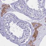 TMEM97 Antibody in Immunohistochemistry (IHC)