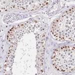 LSM3 Antibody in Immunohistochemistry (IHC)