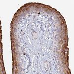 VAT1 Antibody in Immunohistochemistry (IHC)