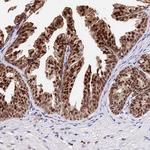 C9orf142 Antibody in Immunohistochemistry (IHC)