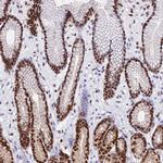 C9orf142 Antibody in Immunohistochemistry (IHC)