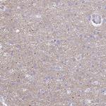 HAPLN2 Antibody in Immunohistochemistry (IHC)