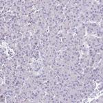 HAPLN2 Antibody in Immunohistochemistry (IHC)