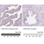 CFAP126 Antibody in Immunohistochemistry (IHC)