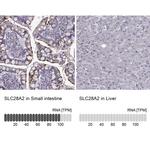 SLC28A2 Antibody