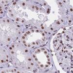 hnRNP UL1 Antibody in Immunohistochemistry (IHC)