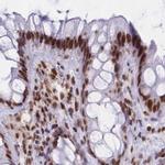 hnRNP UL1 Antibody in Immunohistochemistry (IHC)