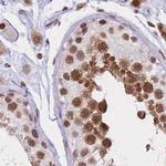 hnRNP UL1 Antibody in Immunohistochemistry (IHC)