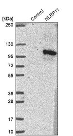 NALP11 Antibody in Western Blot (WB)