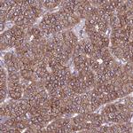 EI24 Antibody in Immunohistochemistry (IHC)