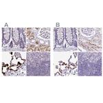 NAPSA Antibody in Immunohistochemistry (IHC)