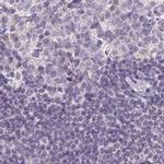 NAPSA Antibody in Immunohistochemistry (IHC)