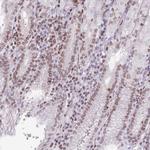 RRNAD1 Antibody in Immunohistochemistry (IHC)