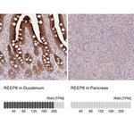 REEP6 Antibody in Immunohistochemistry (IHC)