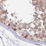 PFDN6 Antibody in Immunohistochemistry (IHC)