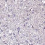 PFDN6 Antibody in Immunohistochemistry (IHC)