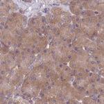 PFDN6 Antibody in Immunohistochemistry (IHC)