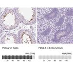 PDCL2 Antibody in Immunohistochemistry (IHC)