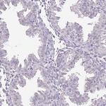 IZUMO4 Antibody in Immunohistochemistry (IHC)