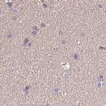 Nhe-1 Antibody in Immunohistochemistry (IHC)