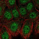 DPF1 Antibody in Immunocytochemistry (ICC/IF)