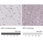 DPF1 Antibody in Immunohistochemistry (IHC)