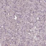 DPF1 Antibody in Immunohistochemistry (IHC)