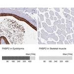 FKBP2 Antibody