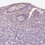 GAL Antibody in Immunohistochemistry (IHC)