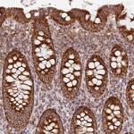 MRPS16 Antibody in Immunohistochemistry (IHC)