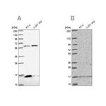 MRPS16 Antibody in Western Blot (WB)