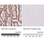 HSD17B2 Antibody in Immunohistochemistry (IHC)