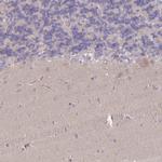 MRPS18B Antibody in Immunohistochemistry (IHC)