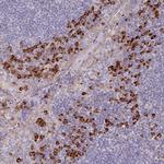 TRAPPC10 Antibody in Immunohistochemistry (IHC)