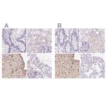 IGFBP-1 Antibody in Immunohistochemistry (IHC)