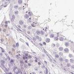 IGFBP-1 Antibody in Immunohistochemistry (IHC)