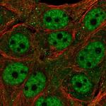 TET3 Antibody in Immunocytochemistry (ICC/IF)