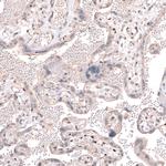 TET3 Antibody in Immunohistochemistry (IHC)