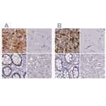 PNMT Antibody in Immunohistochemistry (IHC)